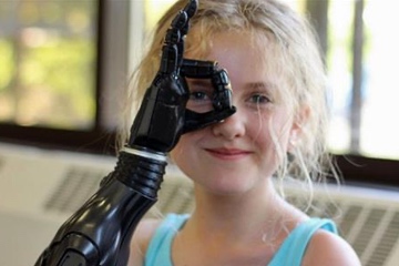 3D Printed Prosthetic Hand.  Young girl gesturing the "ok" hand sign.