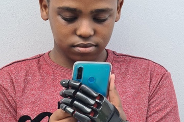 3D Printed Prosethic Hand being used by young man to look at his mobile phone.