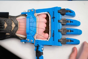 Child's had with poland disease fitted with a 3D printed prosethic hand.